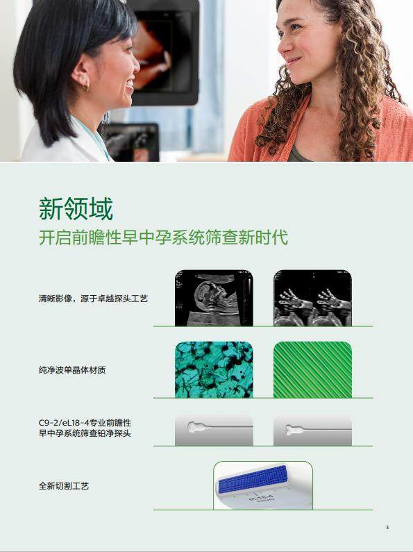 飞利浦Affiniti 70cv超声诊断