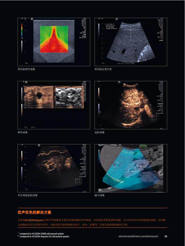 西门子ACUSON  Sequoia超声诊断
