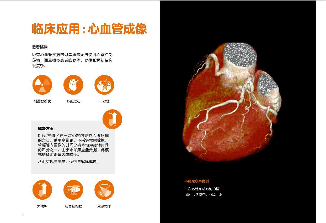 西门子SOMATOM  Drive双源CT