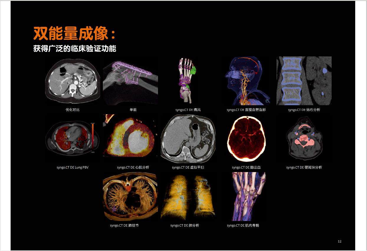 西门子SOMATOM  Drive双源CT