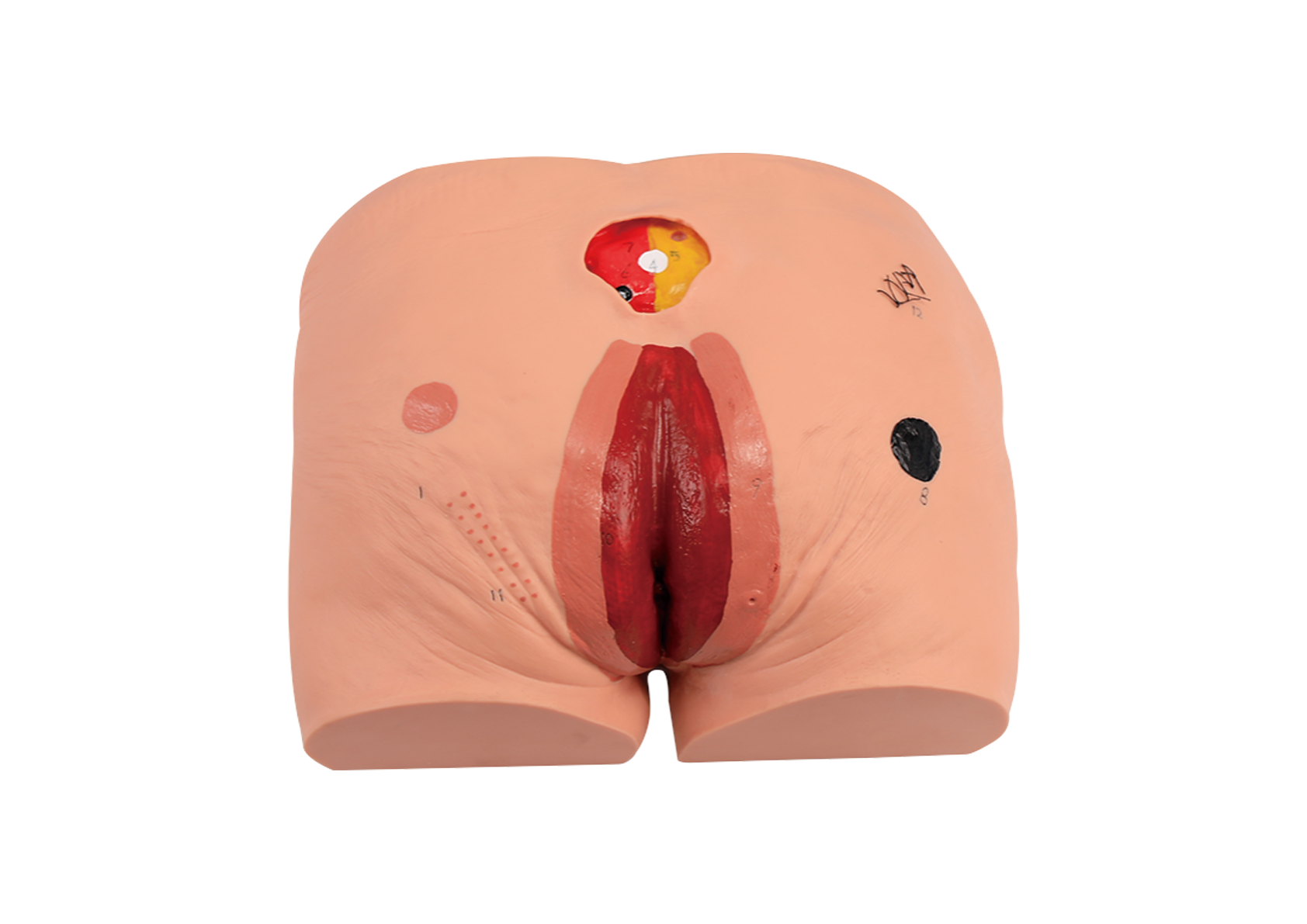 MH024 压疮（褥疮）护理模型