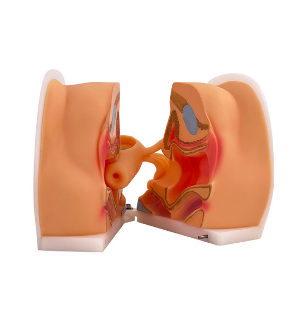MF013 女性避孕器指导模型