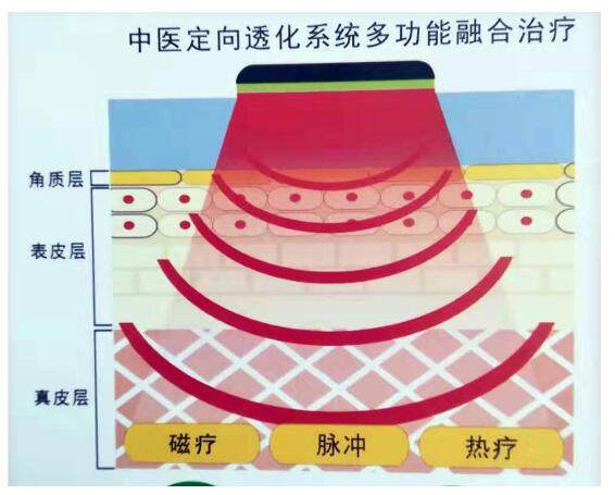 菏泽嘉睿医疗器械有限公司--定向透药治疗仪生产厂家理疗电极片