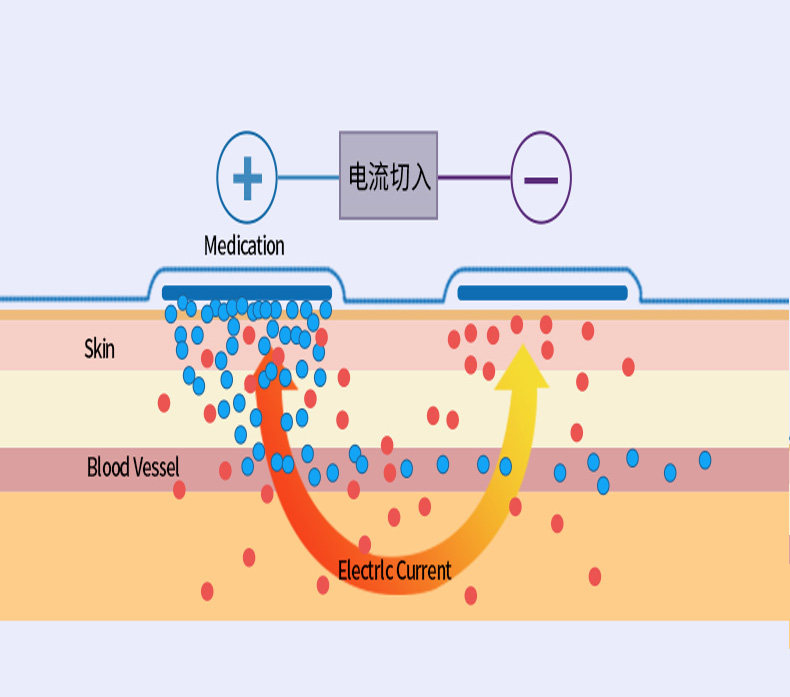 菏泽嘉睿医疗器械有限公司--定向透药治疗仪生产厂家理疗电极片