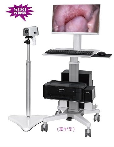 豪华型-数码阴道镜