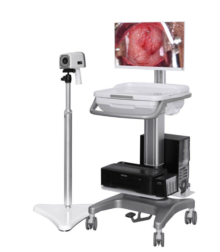 尊享型-数码阴道镜