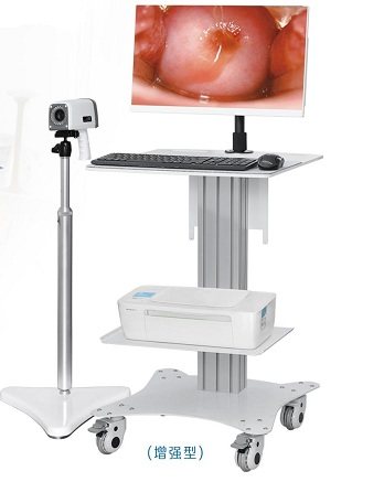 增强型-数码阴道镜