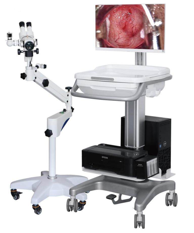 光电一体阴道镜-连续变倍