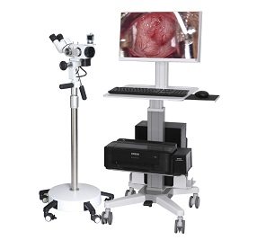 光电一体阴道镜-直立型