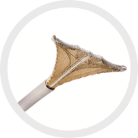 子宫内膜消融术