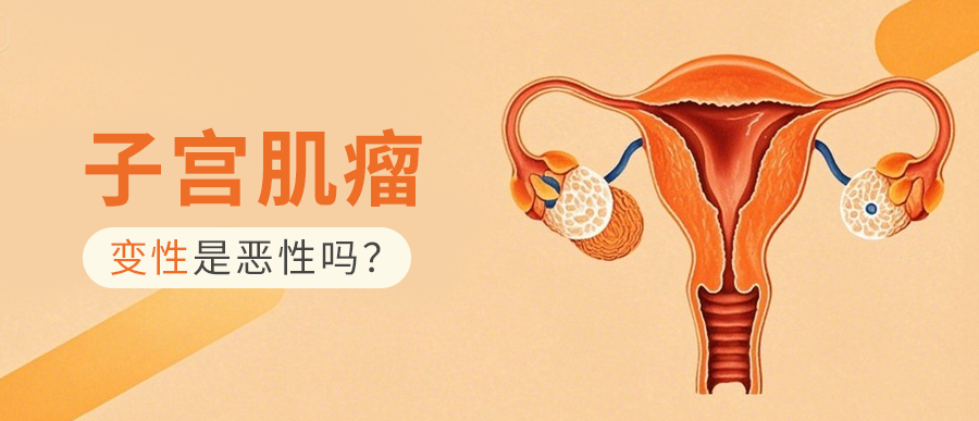 子宫肌瘤变性全解析：正确认知，从容应对