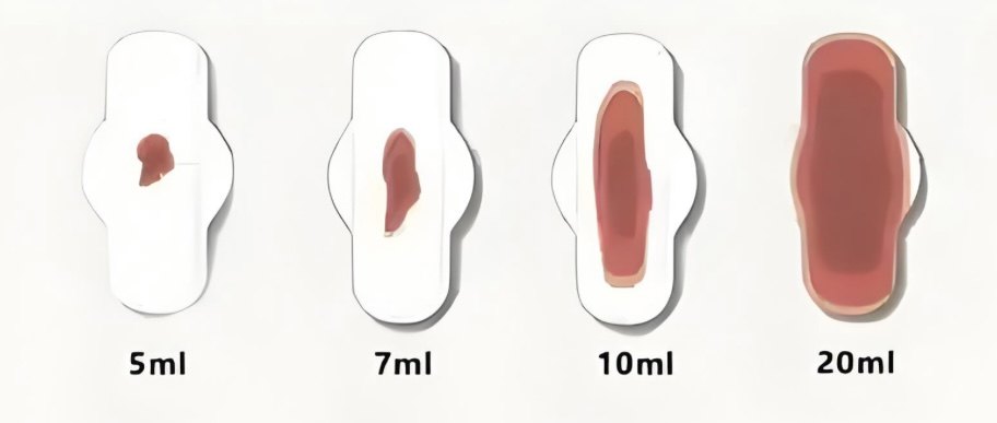 青春期女性异常子宫出血：原因、症状与应对