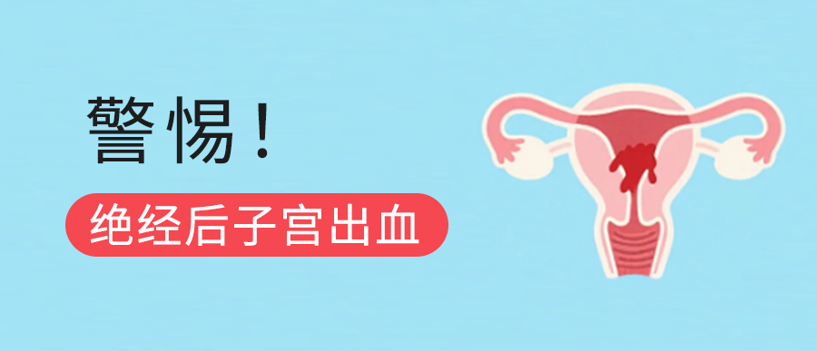 绝经后子宫出血：不必恐慌，但必须警惕！