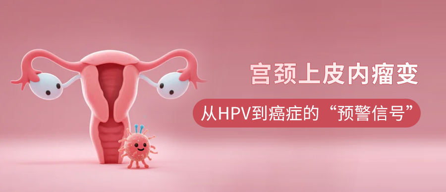 宫颈上皮内瘤变（CIN）：从HPV感染到癌症的“预警信号”