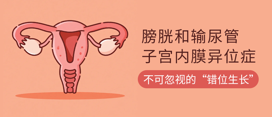 膀胱和输尿管子宫内膜异位症：不可忽视的“错位生长”