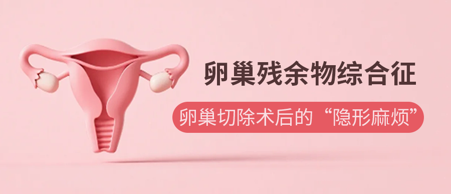 卵巢残余物综合征：卵巢切除术后的“隐形麻烦”