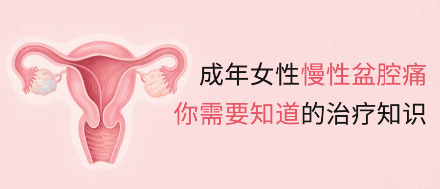 成年女性慢性盆腔痛：你需要知道的治疗知识