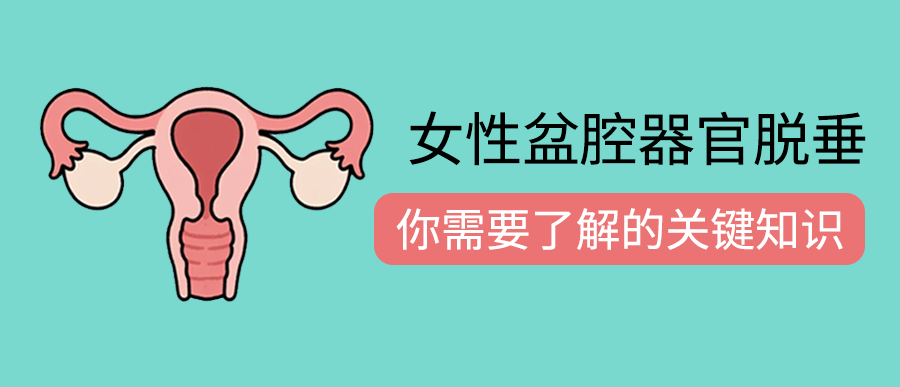 女性盆腔器官脱垂：你需要了解的关键知识