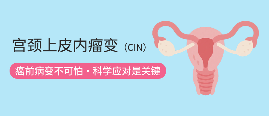 宫颈上皮内瘤变（CIN）：癌前病变不可怕，科学应对是关键