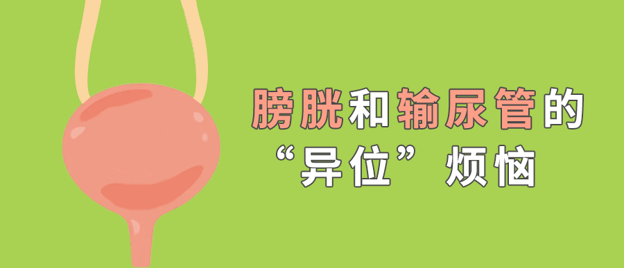 当子宫内膜“跑错地方”：聊聊膀胱和输尿管的“异位”烦恼
