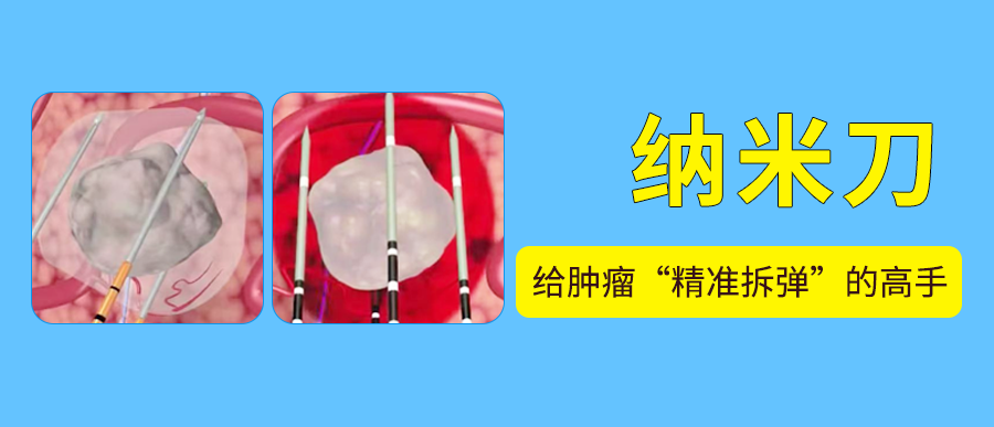 纳米刀：给肿瘤“精准拆弹”的高手