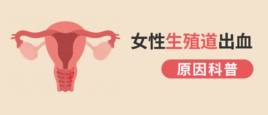 女性生殖道出血的原因科普