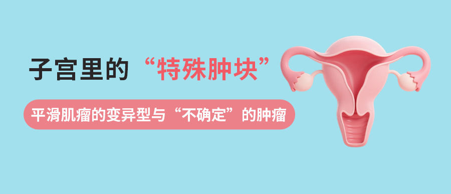 子宫里的“特殊肿块”：聊聊平滑肌瘤的那些变异型与“不确定”的肿瘤