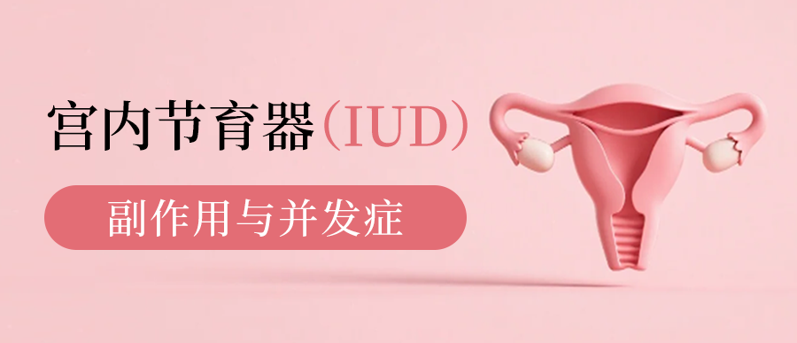 关于宫内节育器（IUD）：你需要知道的副作用与并发症