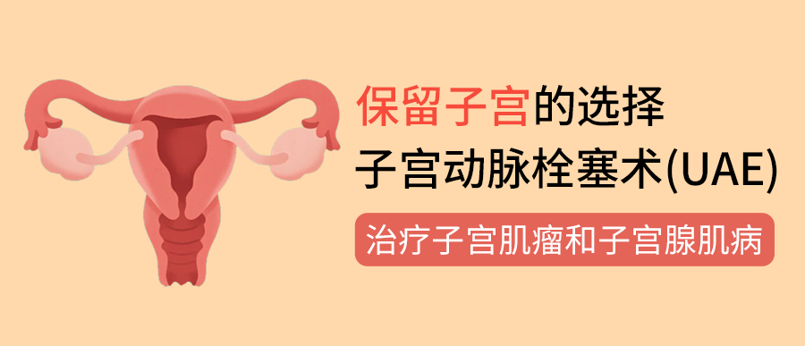保留子宫的选择：深入解读子宫动脉栓塞术（UAE）治疗子宫肌瘤和子宫腺肌病