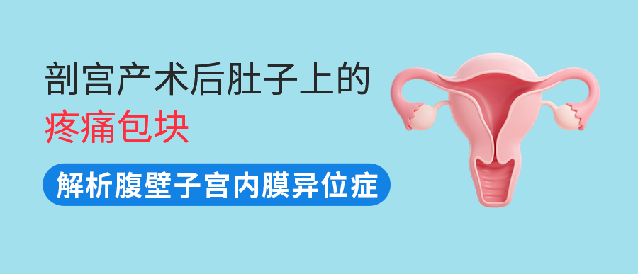 剖宫产术后，肚子上的“疼痛包块”可能是它！一文读懂腹壁子宫内膜异位症