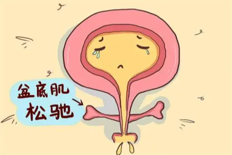 5个实用生活方式调整，帮你缓解尿失禁