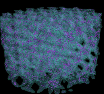 孔隙在钛骨骼支架中的展示