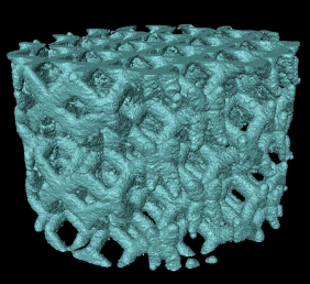 钛骨骼支架材料