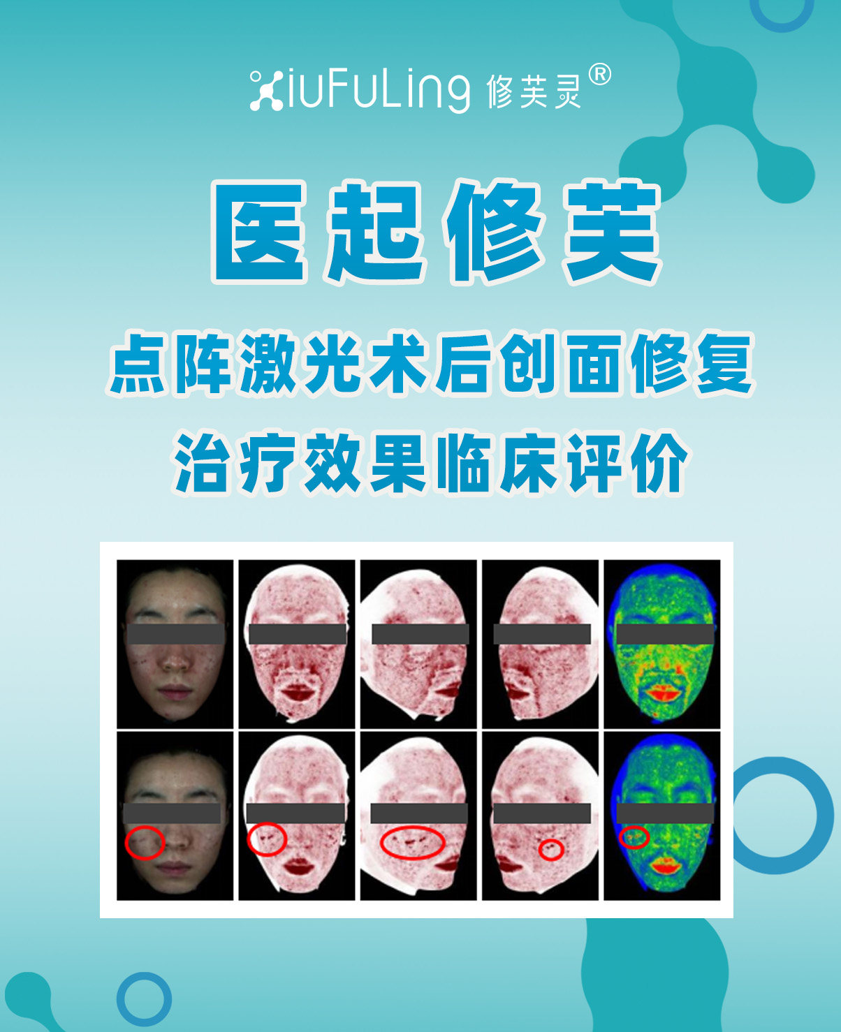 二、点阵激光术后创面修复治疗效果临床评价