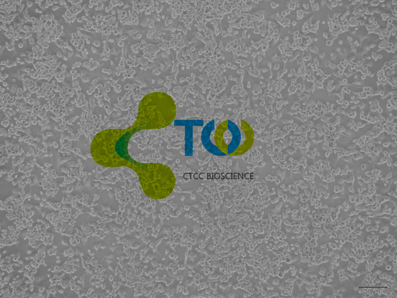 外周血内皮祖细胞