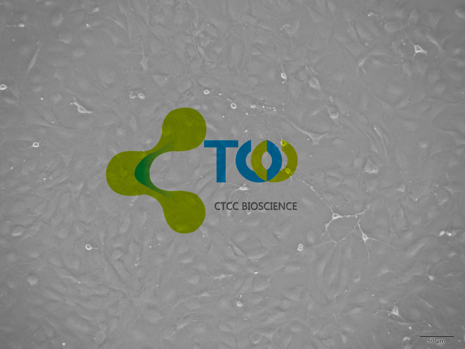 心脏微血管内皮细胞