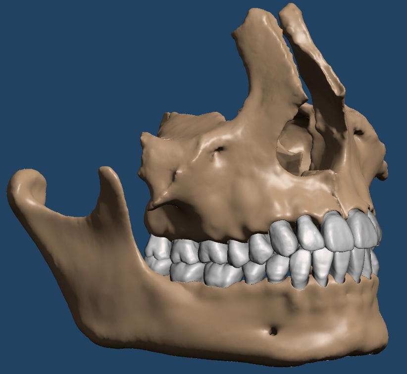 上颌和下颌牙科模型