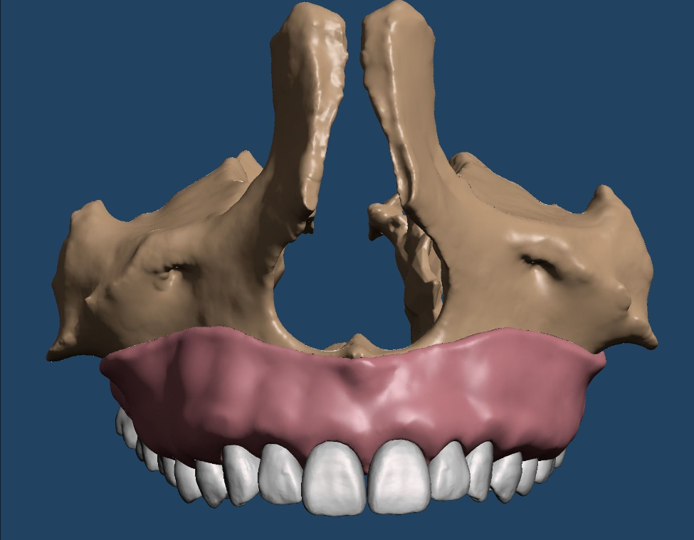上颌和下颌牙科模型