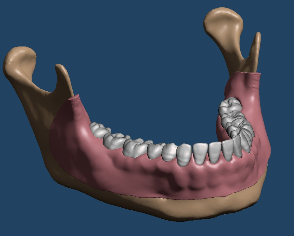 上颌和下颌牙科模型