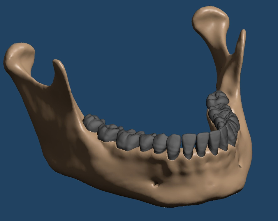 上颌和下颌牙科模型