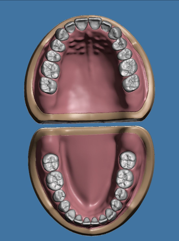 上颌和下颌牙科模型 3D 打印模型