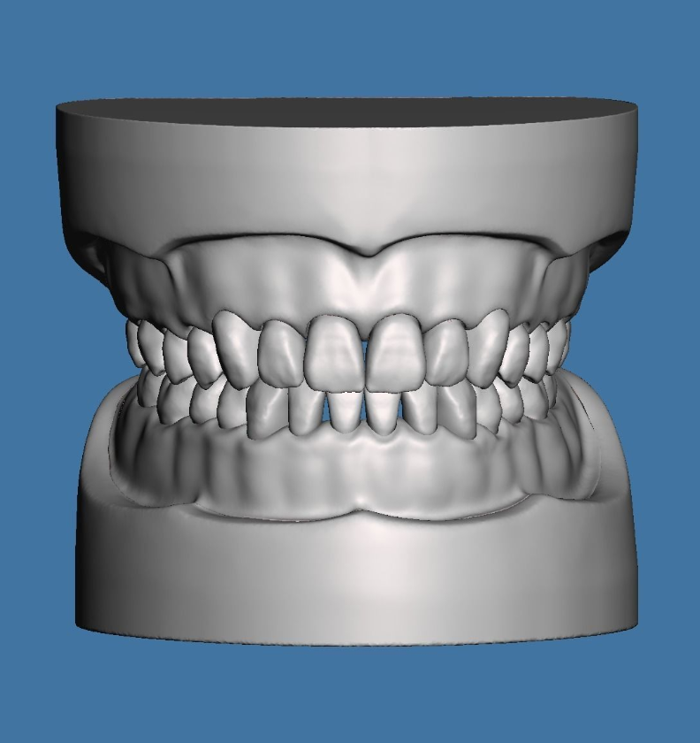 全口牙练习模型
