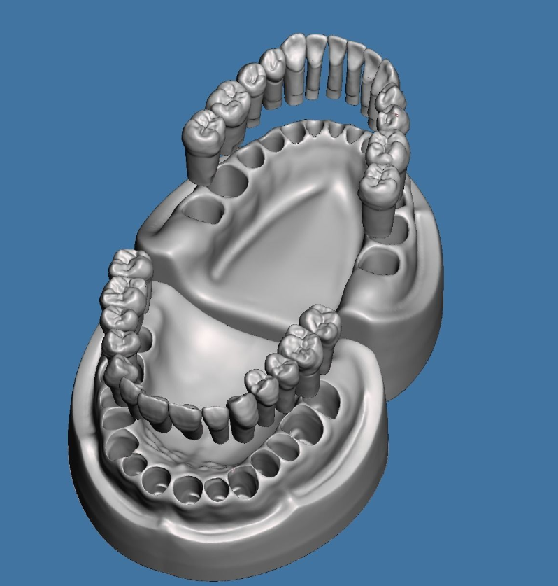 全口牙练习模型