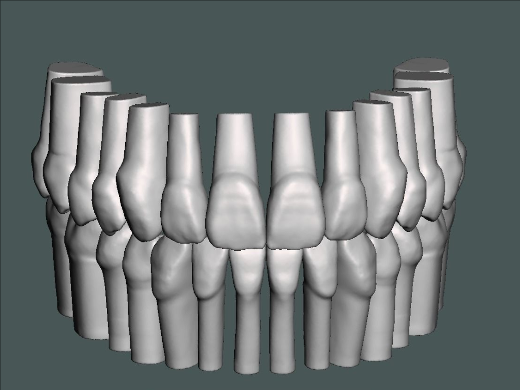 全口牙练习模型