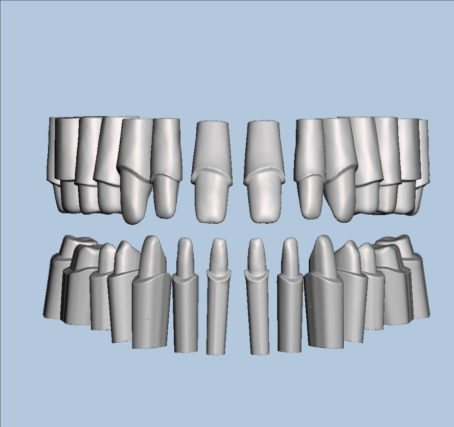 上颌和下颌牙科模型 3D 打印模型