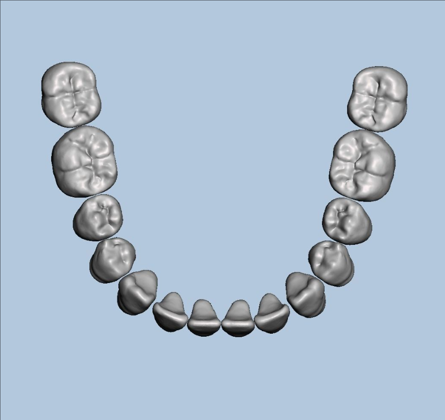 上颌和下颌牙科模型 3D 打印模型