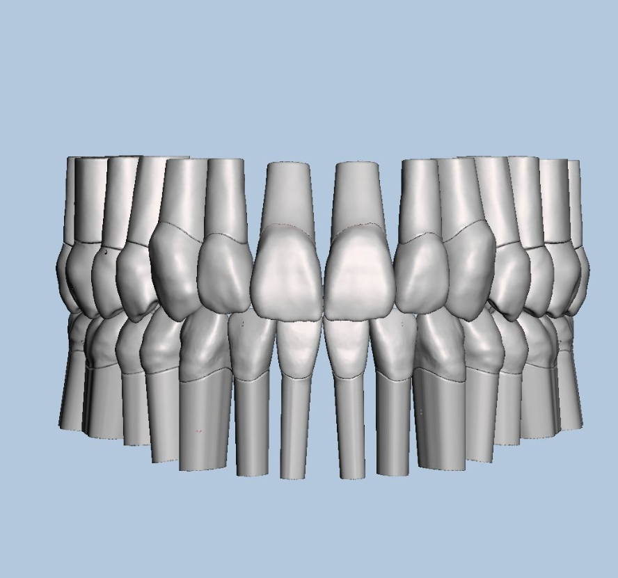 上颌和下颌牙科模型 3D 打印模型