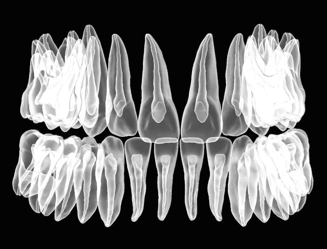 具有天然牙根和根管 3D 打印模型的牙齿解剖模型