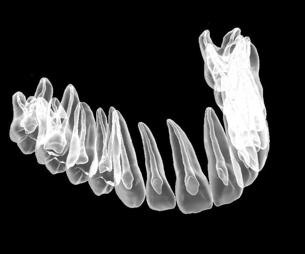 具有天然牙根和根管 3D 打印模型的牙齿解剖模型