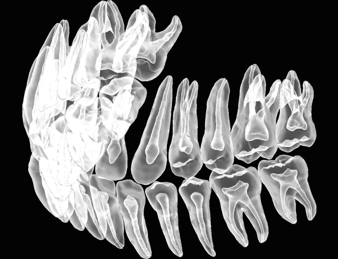 具有天然牙根和根管 3D 打印模型的牙齿解剖模型